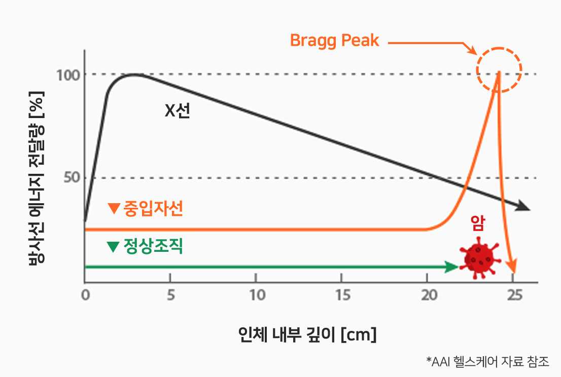 중입자선 치료 VS X-ray 치료