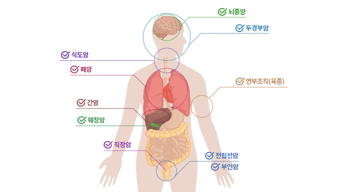 모든 고형암 치료 가능