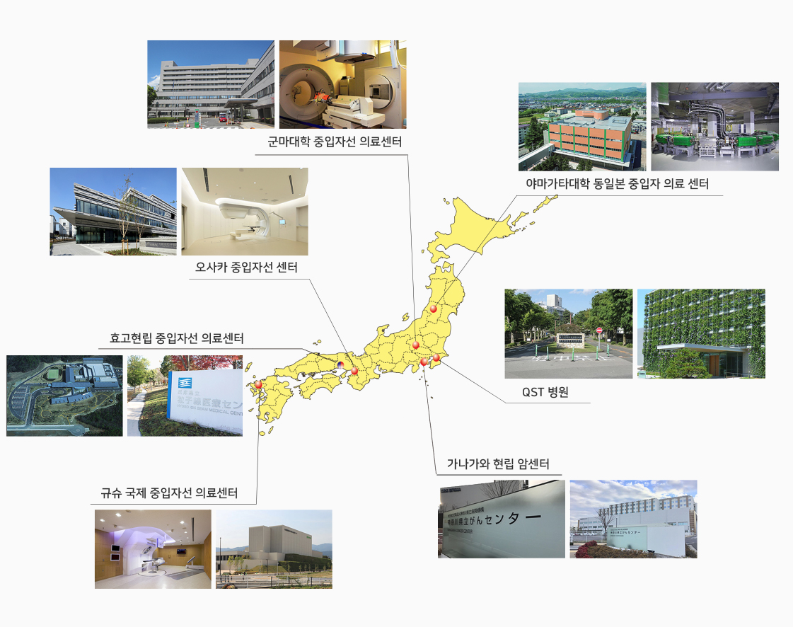 일본의 중입자선 치료시설 분포